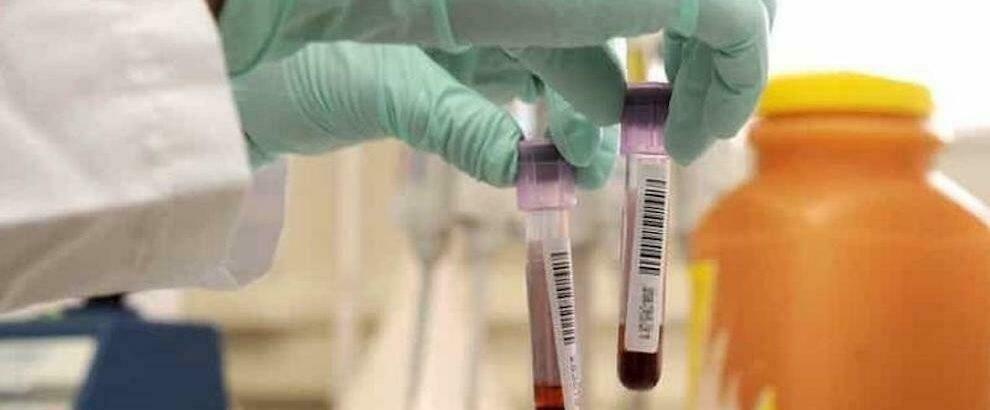 Covid, la Regione Calabria aderisce al progetto europeo per la raccolta del plasma