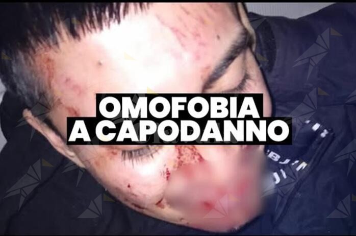 In 10 contro 2 aggrediscono brutalmente una coppia gay. Più Europa: “Continueremo a lottare per un’Italia libera da ogni forma di pregiudizio”